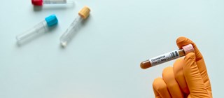 Hand i orange handske håller upp ett provrör med texten coronavirus på.